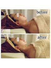 せせら 代々木上原店/当店No.1顔から体内面までのケア