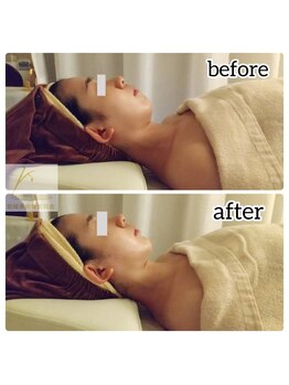 せせら 代々木上原店/当店No.1顔から体内面までのケア