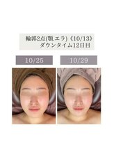 インディバケアプラチナム 横浜店/インディバ施術