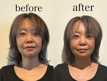 ヴィヴ(Vive)/ドライヘッドスパ60分のお客様