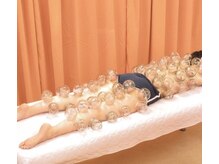 百草足浴堂の雰囲気（肩こり腰痛はカッピングで血流の滞りによる神経圧迫を無くし解消）