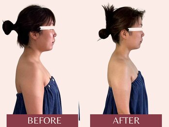 アンリール(Anrire)/【板橋/フェイシャルエステ】