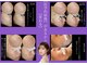 ナースセレクトサロン(Nurse select salon)の写真