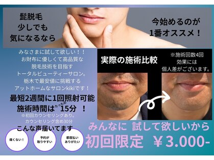 キキ(kiki)の写真