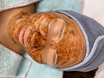 イーヴ(Eave)の写真/【藤井寺初導入☆】カカオ成分×贅沢肌想いピーリングで、内側から輝きを放つ憧れの“多幸肌”へ。