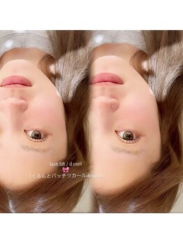 ルナビューティー(Luna beauty)/