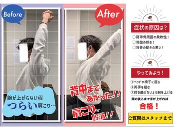ナオル整体 山形院(NAORU整体)/Before→After