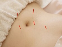 丸太町骨盤整骨院 鍼灸院/女性のお悩み鍼灸