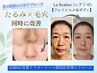 1カ月以内再来!ほうれい線・フェイスライン・毛穴を同時ケア!小顔×肌管理