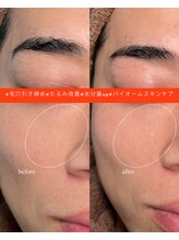 サンク(cinq)/大人気！！ララピール☆彡