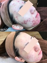 ビアンカ/お客様のお声