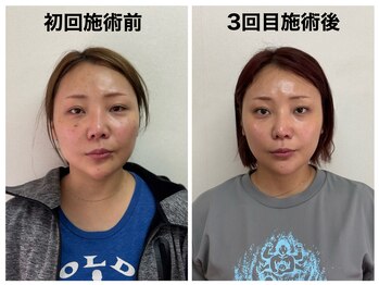 トータルバランス整体院 &nbsp;オレンジ(ORANGE)/小顔矯正/顎関節矯正/大阪梅田