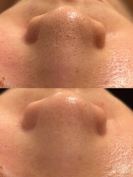 サロン エム(saron M)/お客様ビフォーアフター