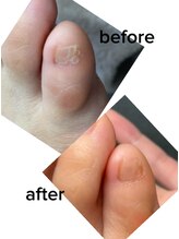 エム 平岸(M)/【副爪（2）】30代女性