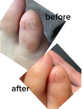 【副爪（2）】30代女性