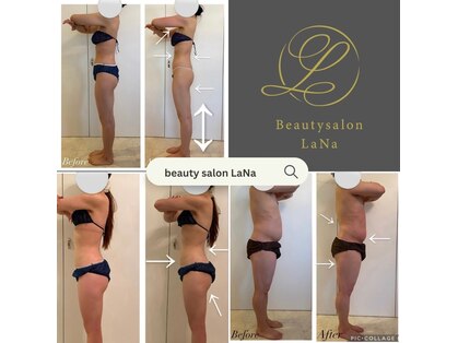 ラナ(LaNa)の写真