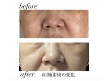 サロン アニムス(salon animus)/毛穴、シミ、くすみ、たるみ