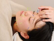 リターズ鍼灸治療所 天王寺院/美容鍼施術/顔のむくみ
