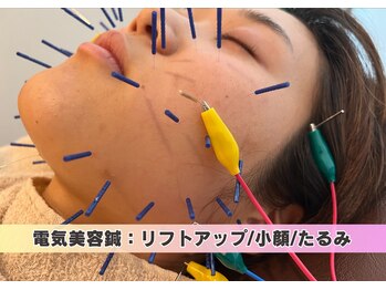 鴨居よつば整骨院/電気美容鍼
