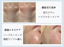 salon Uru.（サロン ウル）|毛穴・ニキビ・美肌専門の雰囲気（毛穴・ニキビケアがが得意です♪）