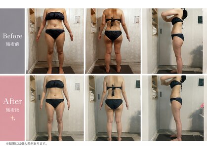ビルーチェ(BELUCE)の写真