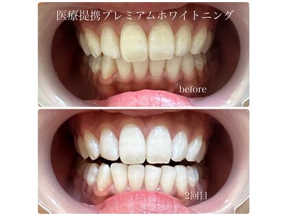 セルフメイド イオンタウン防府店(SELF MADE)の写真