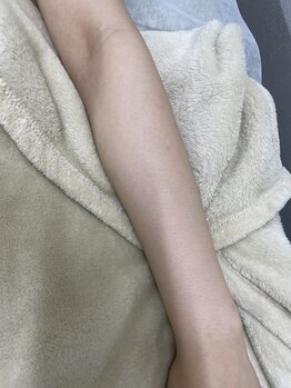 ナノハナ/鹿沼市の全身脱毛のナノハナ