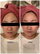 ブランシュール/エンビロンブライトセラム導入