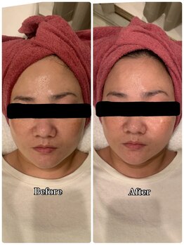 ブランシュール/エンビロンブライトセラム導入