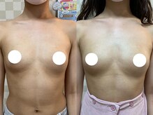 ハレオラ(HaleOla)/お客様の変化☆バストケア