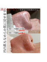 プラスエム(+M)/ボコボコ肌さようなら！