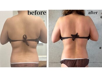 ラムールボーテ(L'AMOUR BEAUTE)/Body