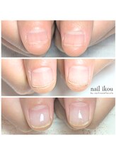 ネイル イコウ(nail ikou)/◇爪を育てる◇