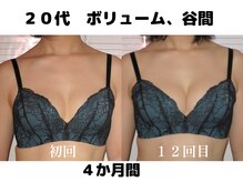 バストサロン メルベイユ(Merveile)/ボリュームUPで谷間クッキリ