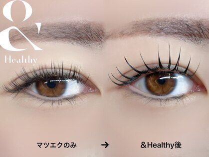 ピコタン(picotin)の写真