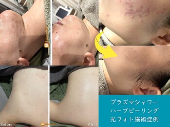 ミーアップ(Me up)