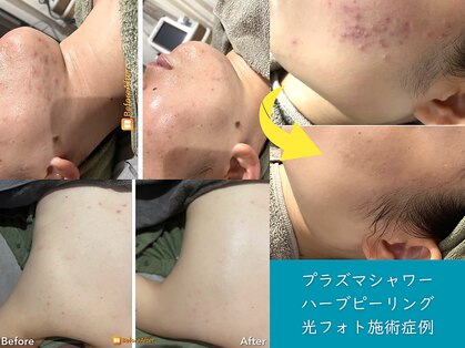 ミーアップ(Me up)の写真