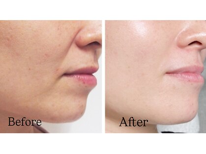 エステティックサロン ティアモ(Ti Amo)の写真