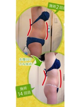 1回ごとにお支払い可能なサロン