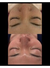 ビューティーサロン アンジェリーク