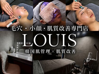 ルイス(LOUIS)の写真