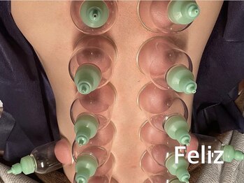フェリス(Feliz)の写真/カッピングで身体の奥から徹底デトックス！血行から整える本気のケアを◎施術後のスッキリ感はやみつきに♪