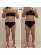 スペチアーレ 夙川/高額マシンが全部出来ちゃう♪