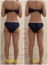 スペチアーレ 夙川/浮腫とサヨナラ、スッキリ脚長