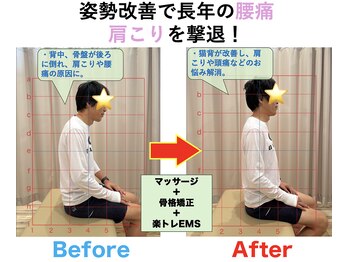 八乙女マイル接骨院/肩こり頭痛小顔矯正 30代女性