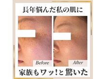 ココ(KOKO)/御家族が驚く変化!!