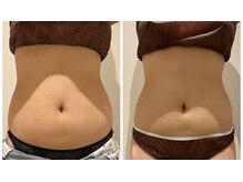 エイシスグロウ(asis glow.)/効果写真