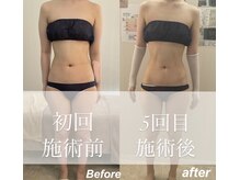 ミセル(MISEL2nd)/キープ力◎リピートNo.1最新痩身