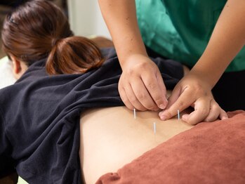 はせがわ鍼灸整骨院の写真/凝り固まった身体、急な腰痛の方におすすめ!鍼灸で身体の緊張を緩めます!