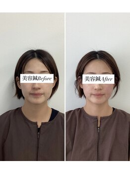 ハリサロンドオフ 堺東店(hari salon de off)/お客様before→after